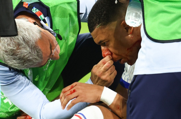 Mbappe doubtful for Netherlands with broken nose as France beat Austria 1-0