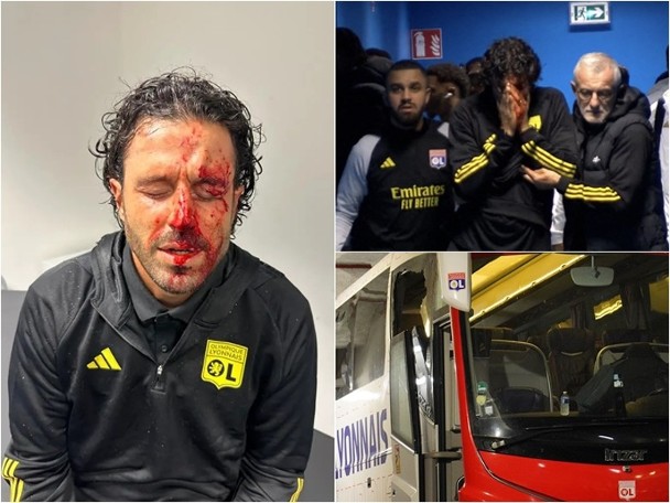 Lyon bus attacked, Grosseau bloodied, race canceled.